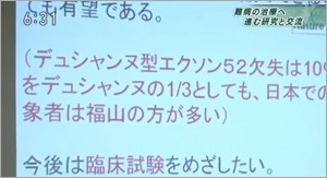 福山型がNHKニュースになりました！